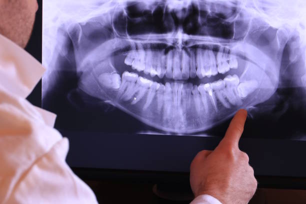Best Emergency Treatment for Jaw Pain or Injury in Hanapepe, HI