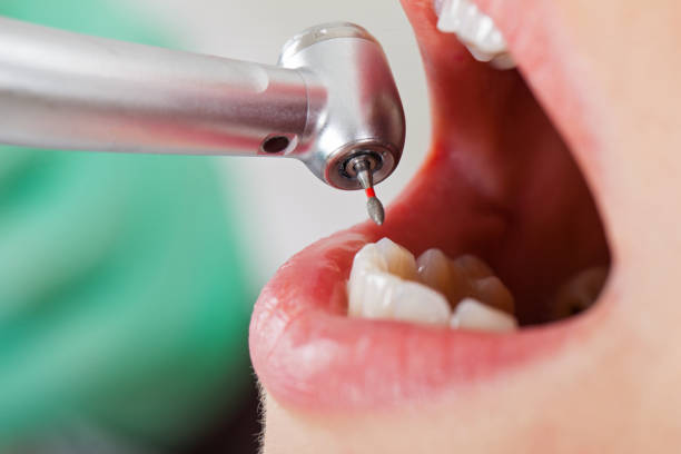 Best Emergency Dental Care for Sports Injuries in Hanapepe, HI